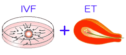 IVF+ET2