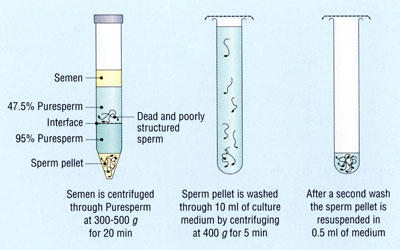 sperm2