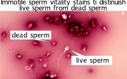 spermTest2