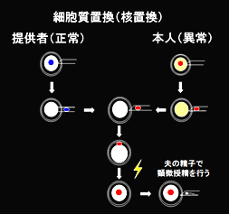 卵細胞質置換