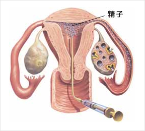 後 妊娠 安静 射精 子作りの行為後の処理