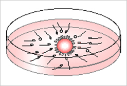 IVF