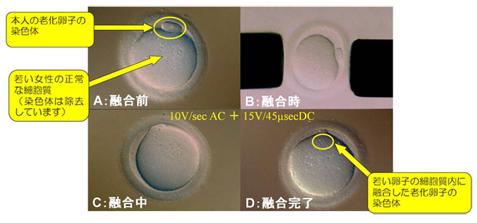 老化卵子に対する核置換（細胞質置換）の研究