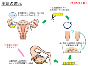 賦活化法 実際の流れ