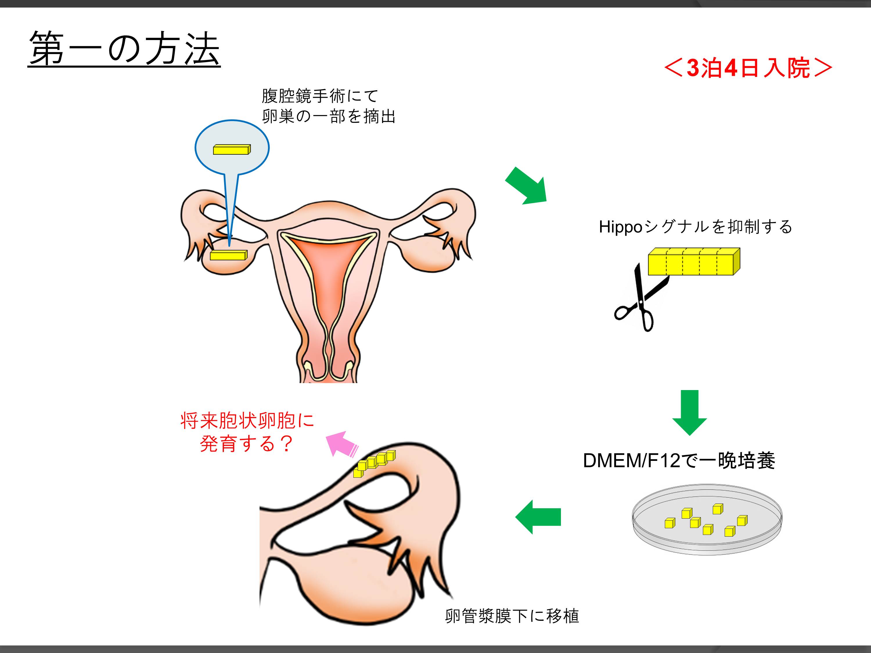新しい卵巣機能低下の回復法 セントマザー産婦人科医院 新しい卵巣機能低下の回復法 セントマザー産婦人科医院