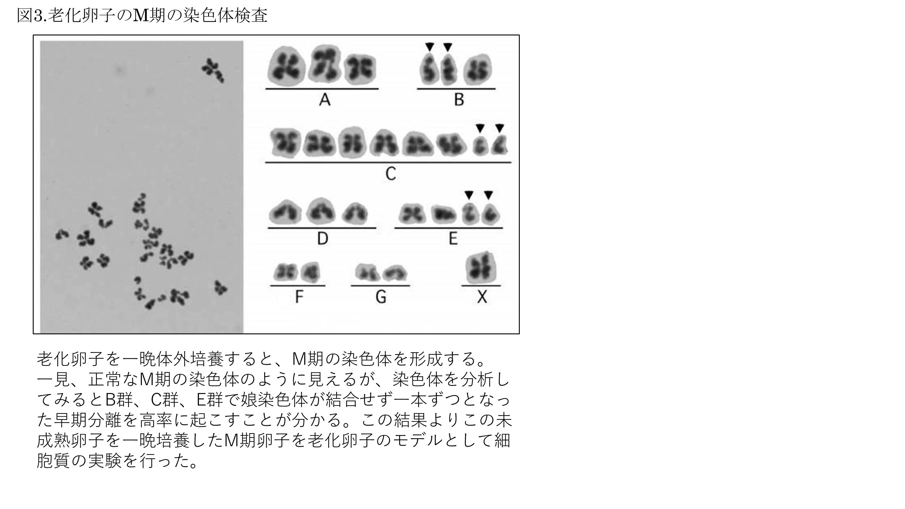 着床前診断(PGT-A、PGT-SR、PGT-M)について - セントマザー産婦人科医院