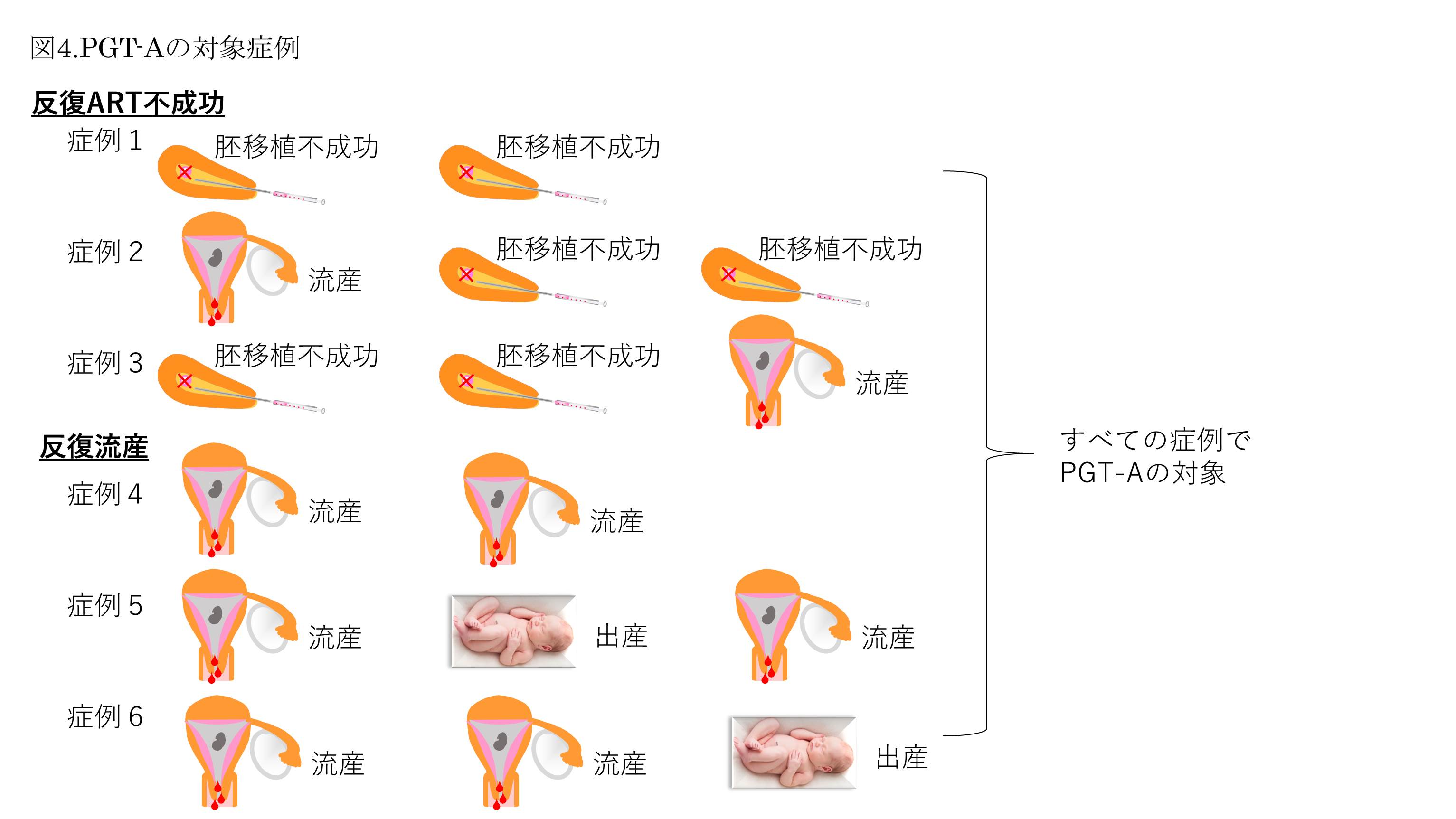 着床前診断(PGT-A、PGT-SR、PGT-M)について - セントマザー産婦人科医院