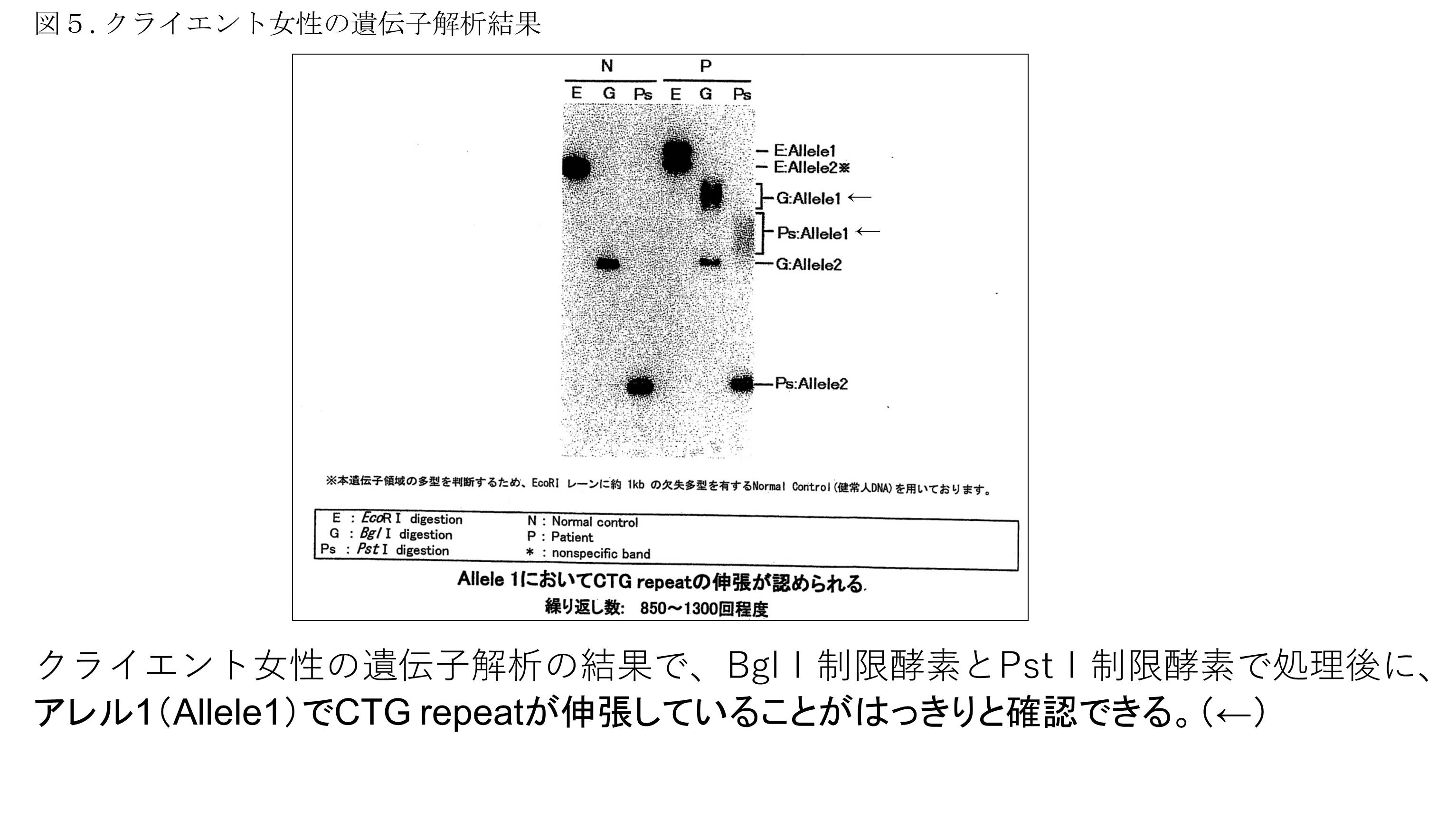 着床前診断(PGT-A、PGT-SR、PGT-M)について - セントマザー産婦人科医院